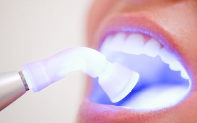 ¿Qué es un blanqueamiento dental?